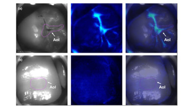 Clinical validation of a novel bioluminescence imaging technology for aiding the assessment of carious lesion activity status