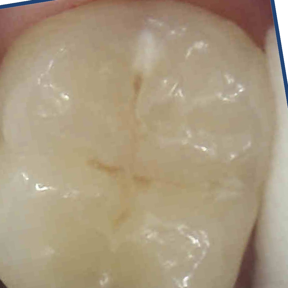 Quiz Image