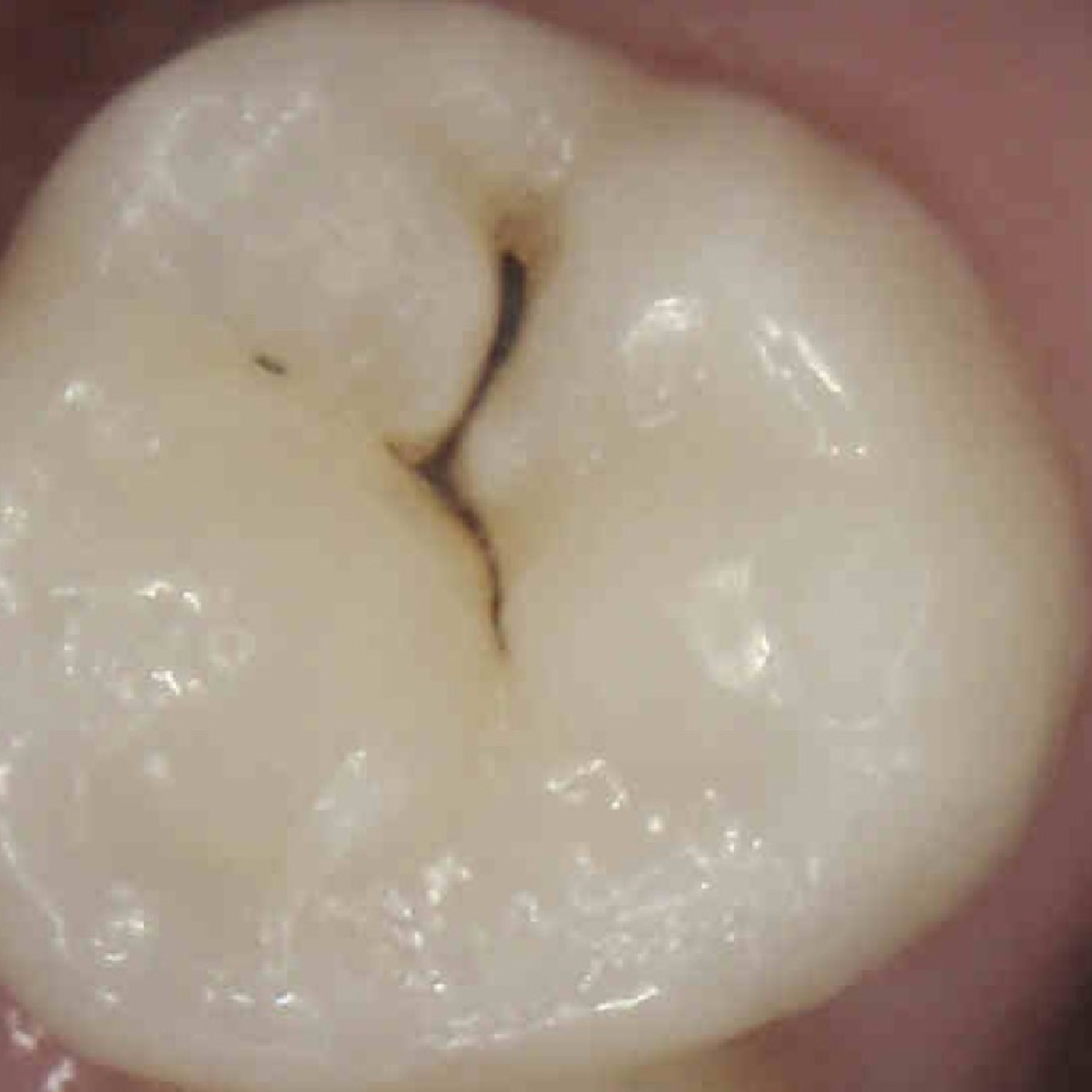 Quiz Image