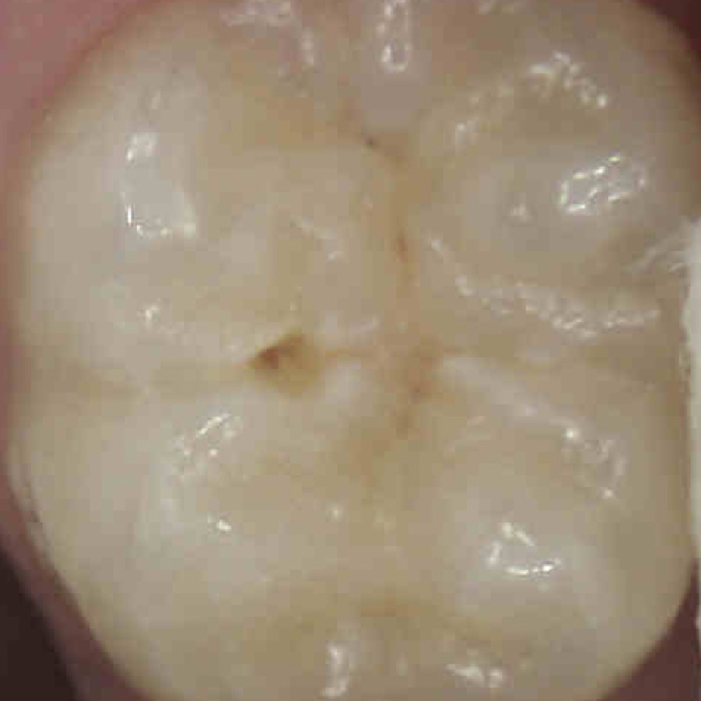 Quiz Image