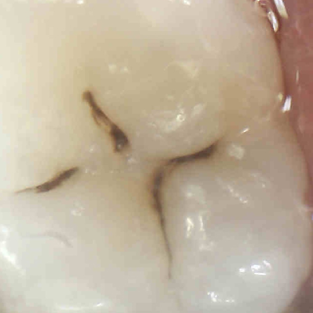 Quiz Image